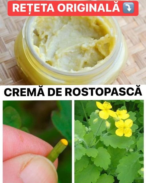 Crema de Rostopască unul dintre cele mai eficiente unguente împotriva psoriazisului și a negilor. Are efecte antispastice analgezice antiseptică antibacteriană regenerantă cicatrizantă și antitumorală